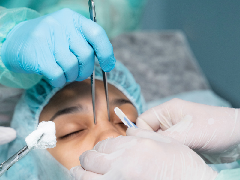 rhinoplasty and primary rhinoplasty