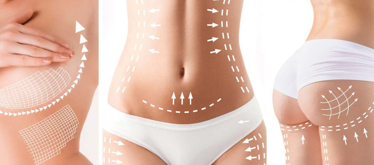 Liposuction in Turkey