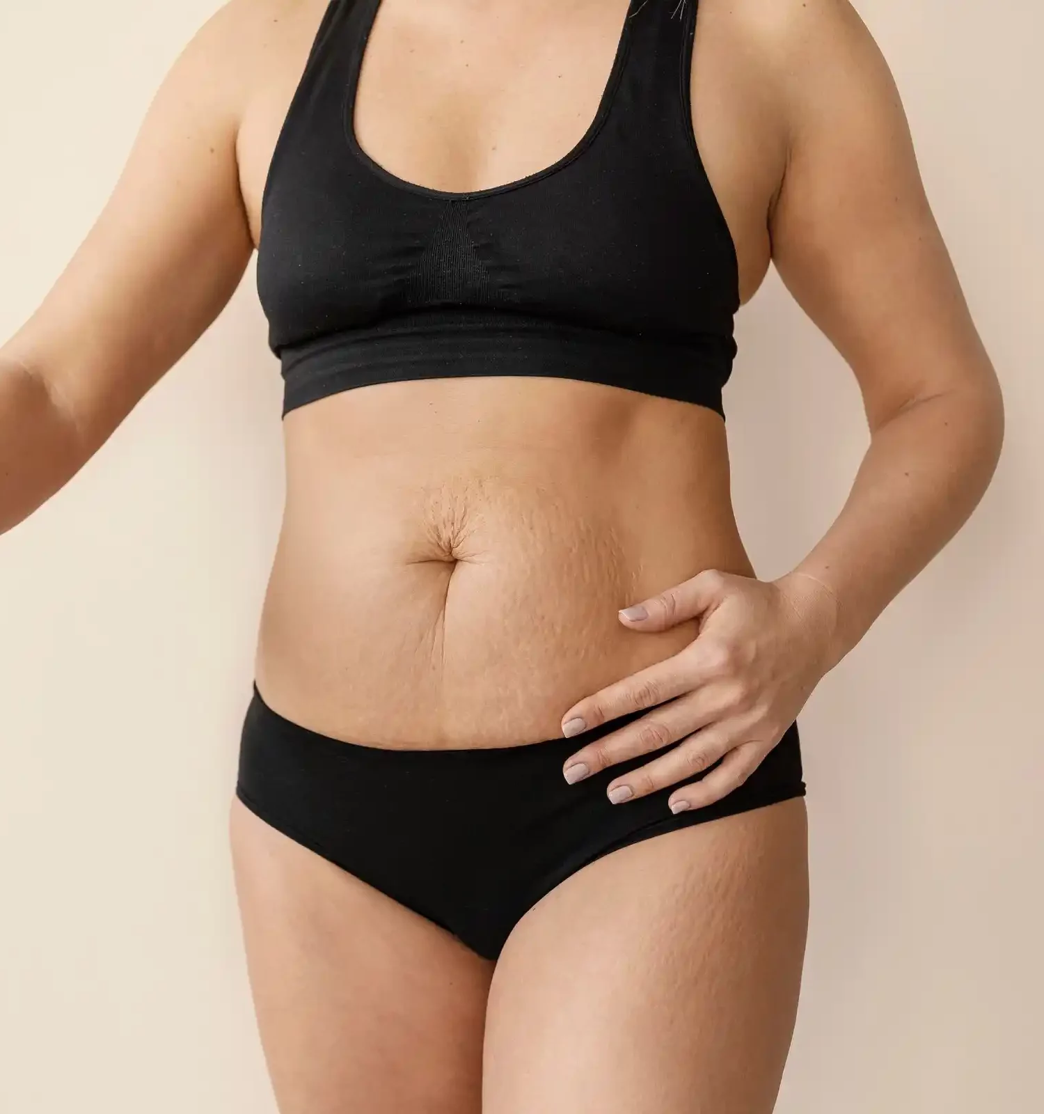 Cambio de imagen de mamá 6 Mommy Makeover Cost in Turkey 1 e1761520231912