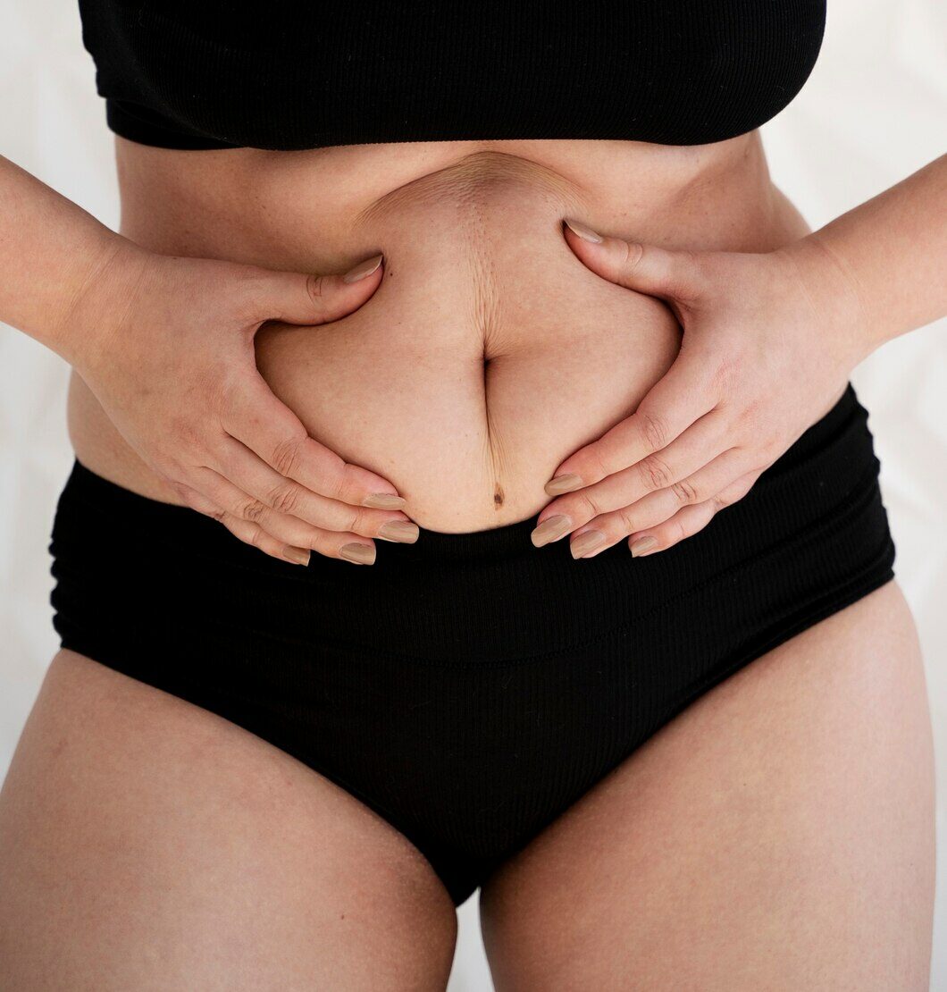 Plastie abdominale 16 front view woman holding her belly 23 2149350122 e1761522046911