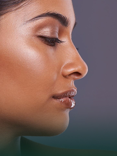 Ethnische Rhinoplastik 3 Ethnic Rhinoplasty