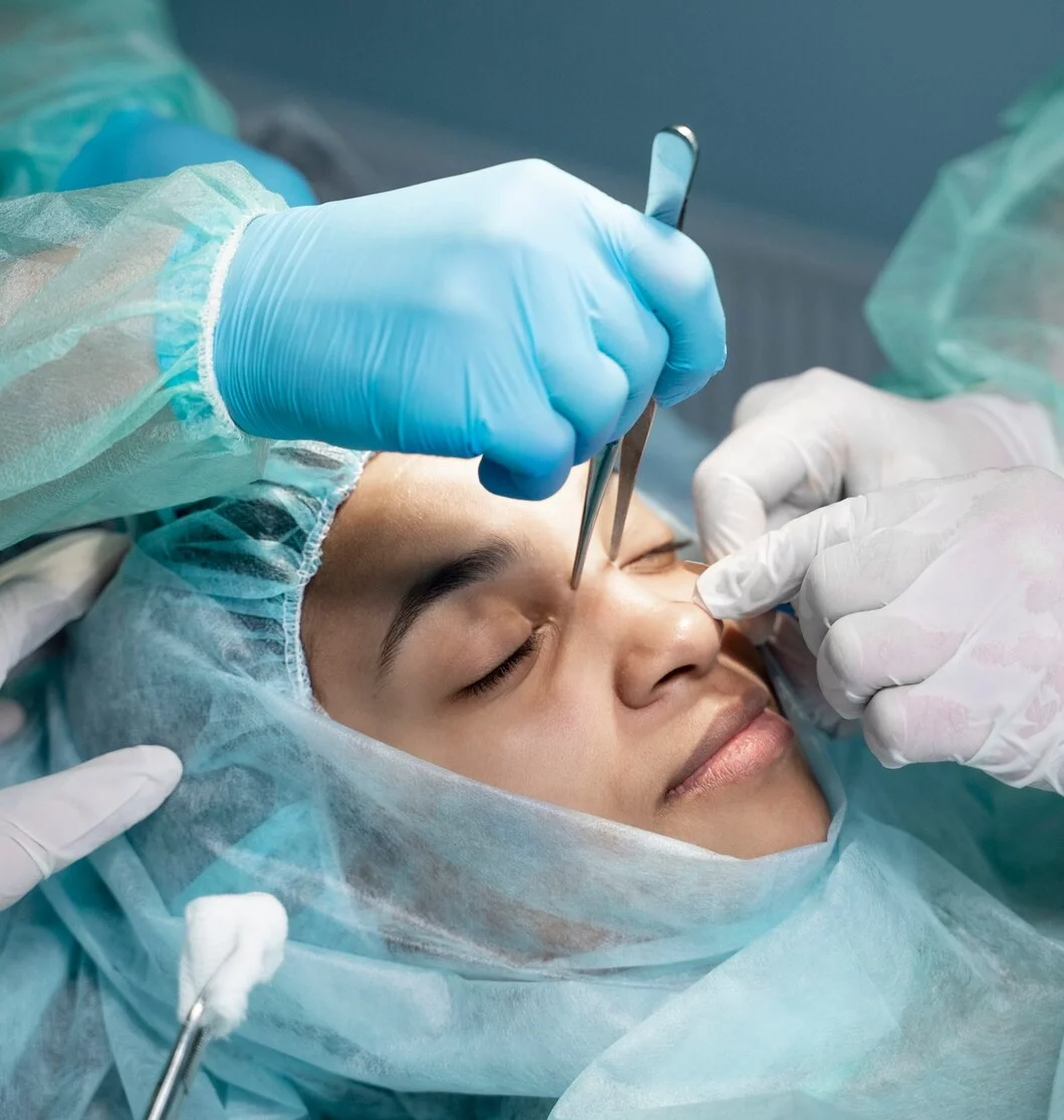 Revision (Zweite) Rhinoplastik 14 Revision Rhinoplasty Turkey Istanbul 5 e1763078913956