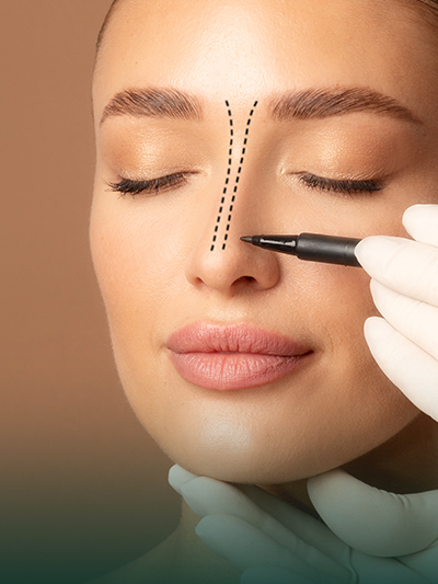 Nasenkorrektur 1 Rhinoplasty