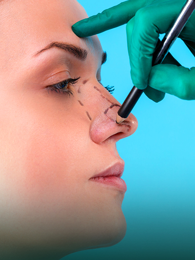 Spitzenplastik 4 Tip Plasty