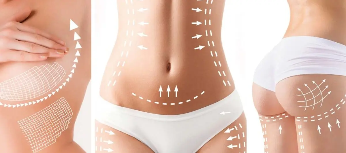 Liposuction in Turkey e1739208434952