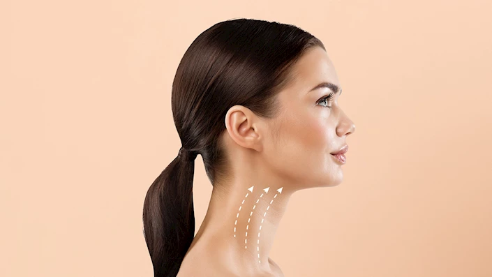 What is the Ideal Age for Neck Lift Surgery? 1 What is the Ideal Age for Neck Lift Surgery