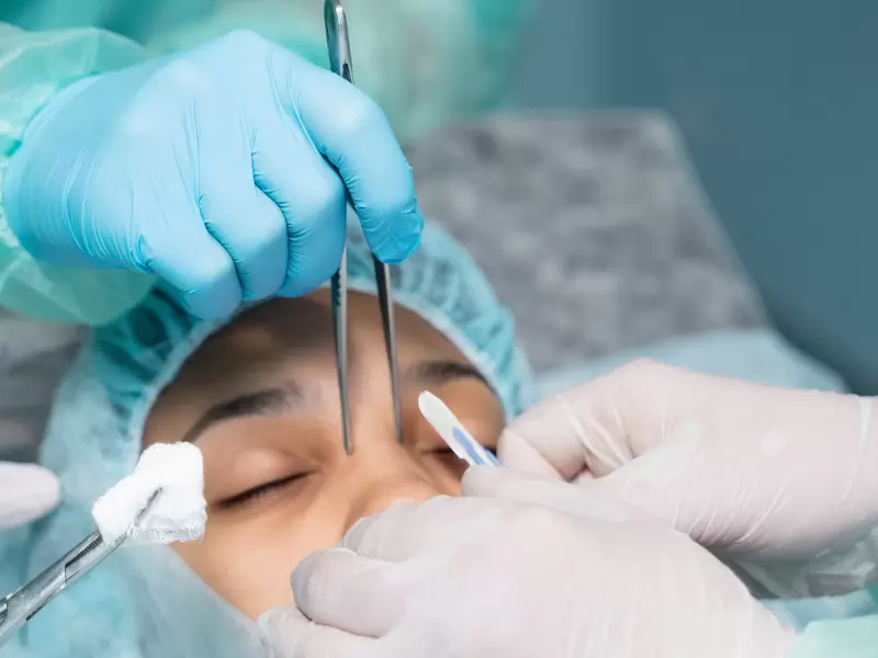 differences between revision rhinoplasty and primary rhinoplasty