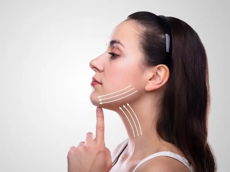 neck lift surgery